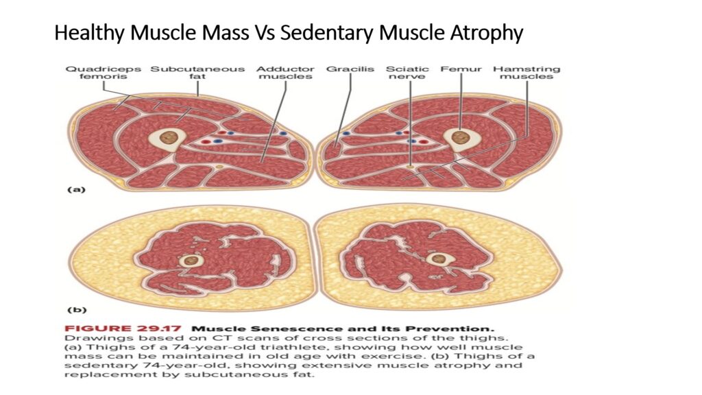 Information to patients how Healthy muscle and weak muscles look like