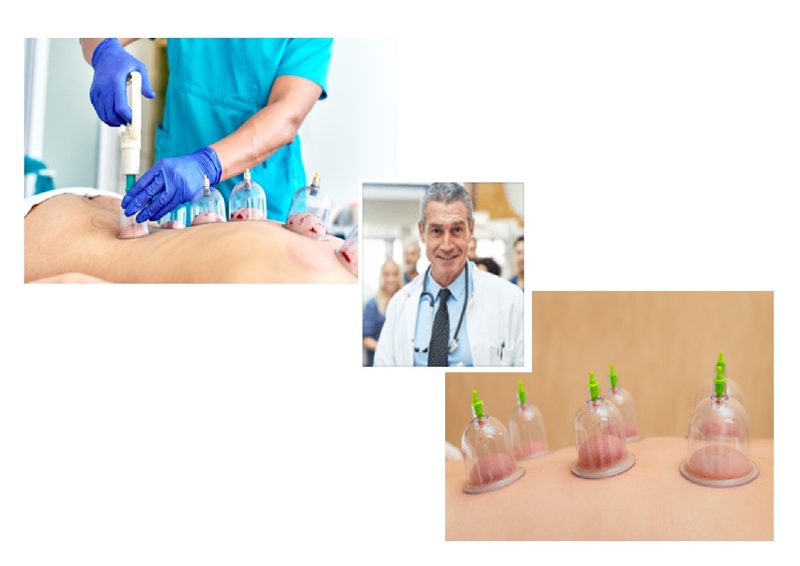 Photo shows Wet /Dry Cupping Comparison