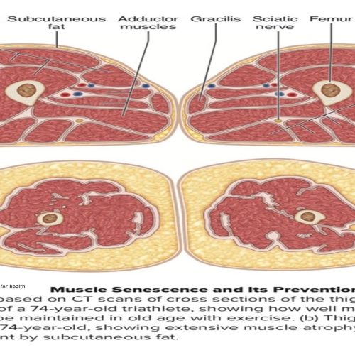 Photo Describing Healthy Muscle Vs Sedentary Muscle Atrophy