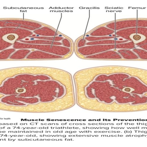 Photo Describing Healthy Muscle Vs Sedentary Muscle Atrophy